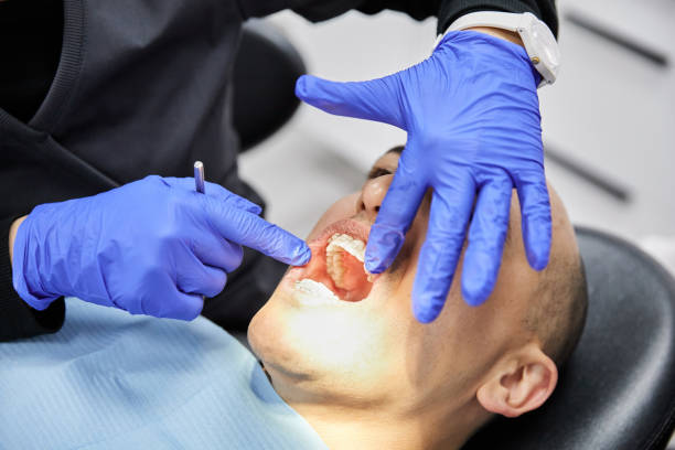 Best Emergency Treatment for Dental Infections or Abscesses in Bell Gardens, CA
